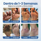 VitaGluco: Tratamiento Botánico para "Pies de Azúcar" - Adiós a la "Rasquiña" Nocturna