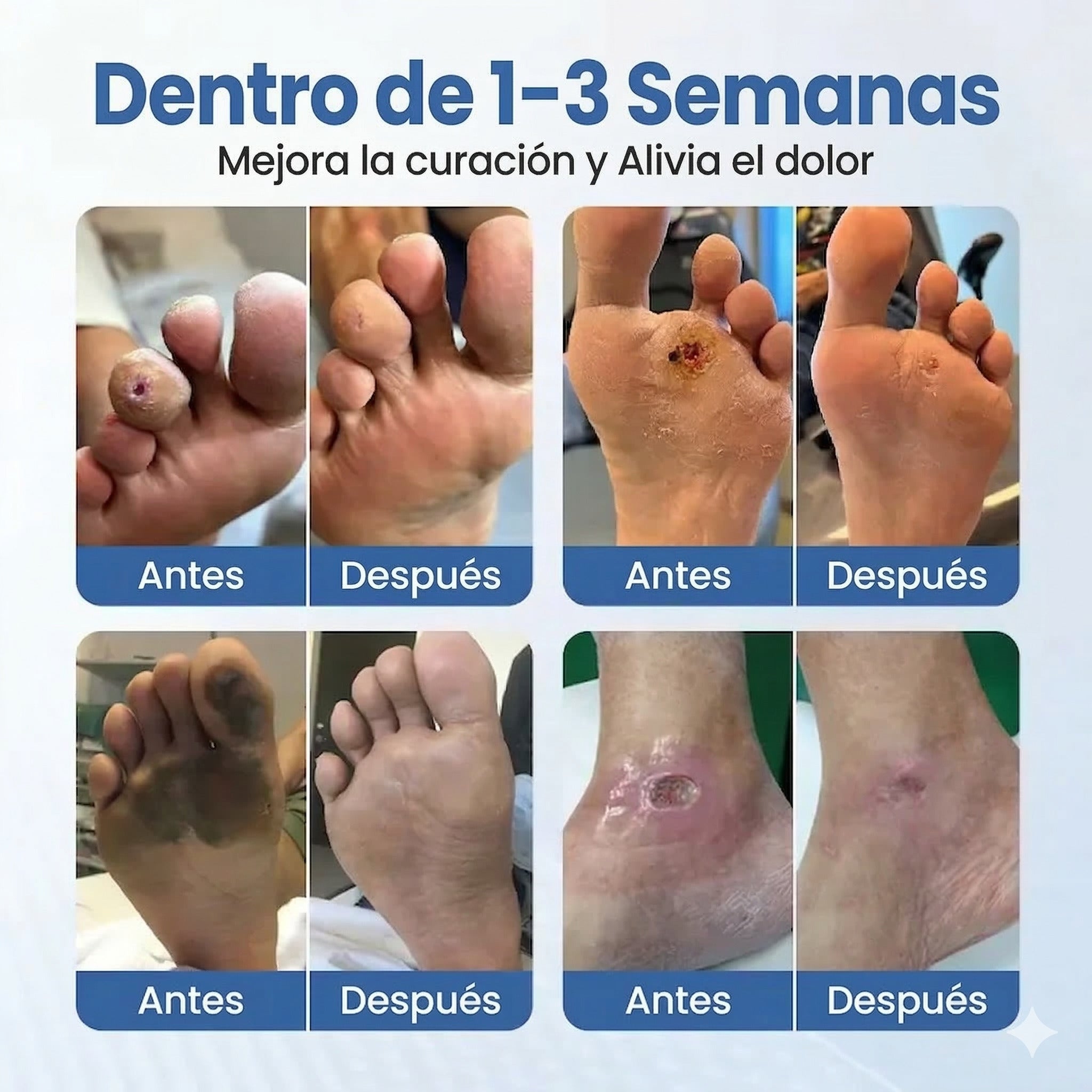 VitaGluco: Tratamiento Botánico para "Pies de Azúcar" - Adiós a la "Rasquiña" Nocturna