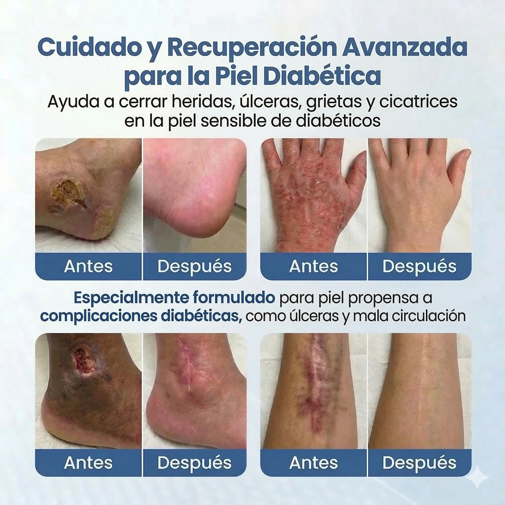 VitaGluco: Tratamiento Botánico para "Pies de Azúcar" - Adiós a la "Rasquiña" Nocturna