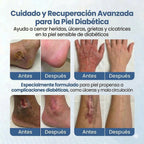 VitaGluco: Tratamiento Botánico para "Pies de Azúcar" - Adiós a la "Rasquiña" Nocturna